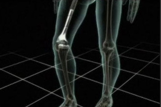“ģ”
